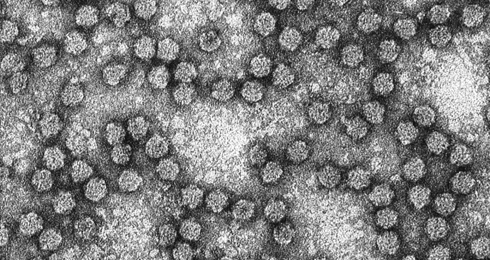 Nanoviridae