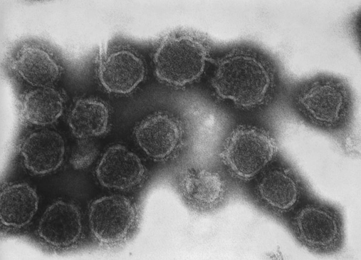 Peribunyaviridae
