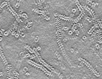 Pneumoviridae