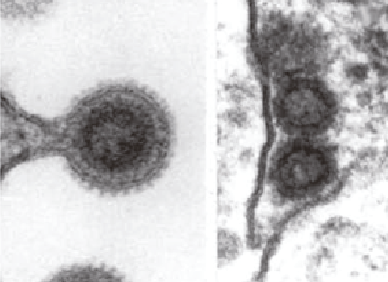 Retroviridae