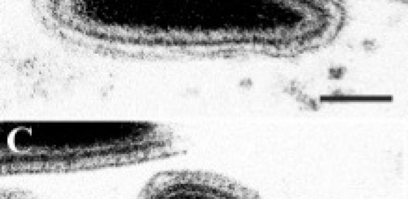 Ascoviridae