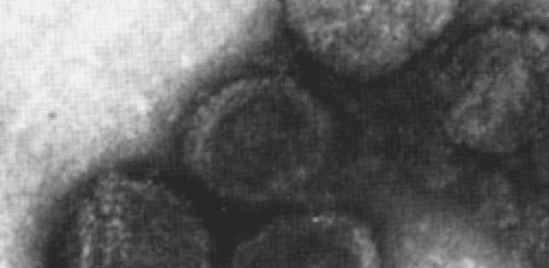 Plasmaviridae