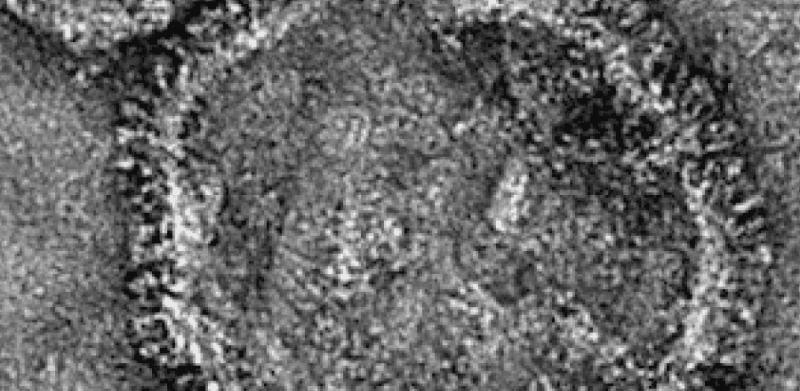 Pneumoviridae