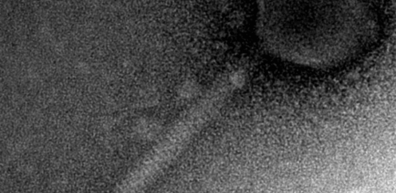 Hepeviridae