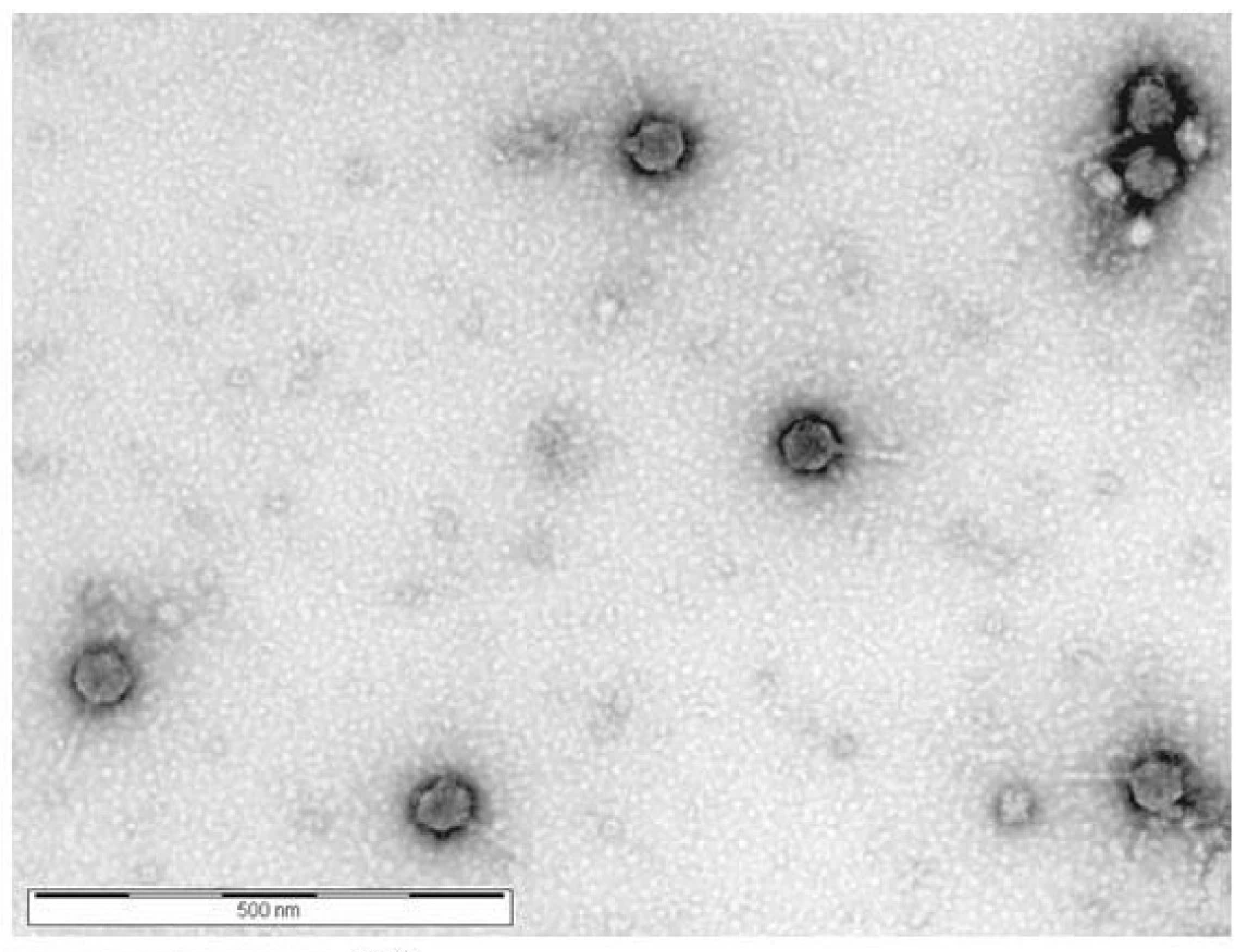 Graaviviridae virion EM
